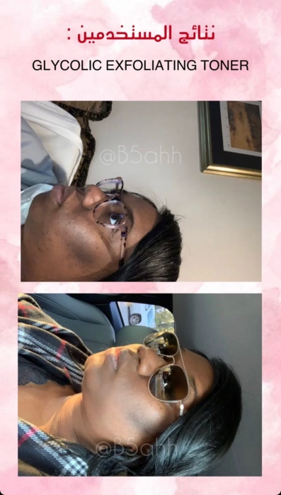 Good molecules, GLYCOLIC EXFOLIATING TONER  